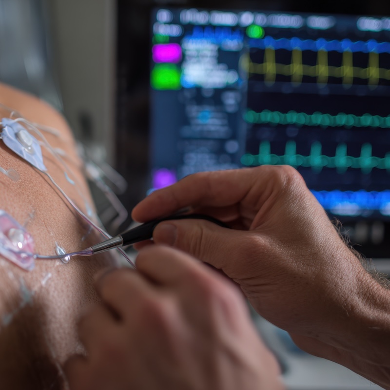 EKG Monitor and Sensors